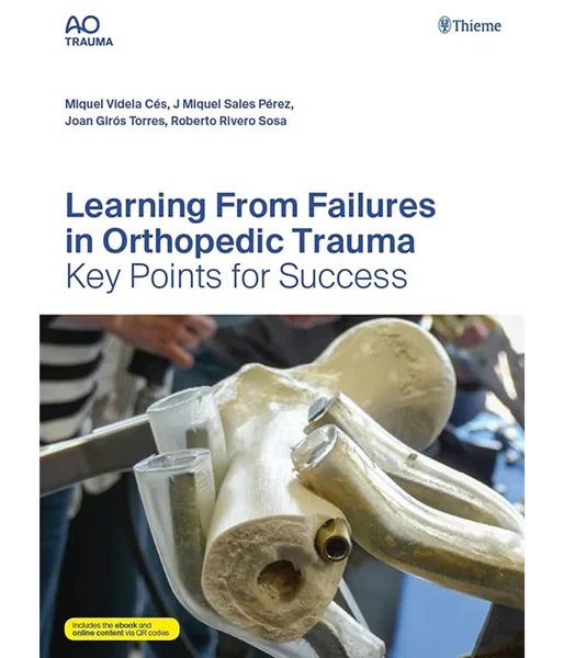 Learning From Failures in Orthopedic Trauma: Key Points for Success, Miquel Videla Cés, B0CKTXH1BC, 3132434566, 3132434574, 3132582751, 9783132434578, 9783132434561, 9783132582750, 978-3132434578, 978-3132434561, 978-3132582750