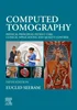 Computed Tomography: Physical Principles, Patient Care, Clinical Applications, and Quality Control 5th Edition, Euclid Seeram, B0B4KH4JV8, 0323790631, 9780323790635, 9780443107009, 9780443107023, 9780323716505, 978-0323790635, 978-0443107009, 978-044310702