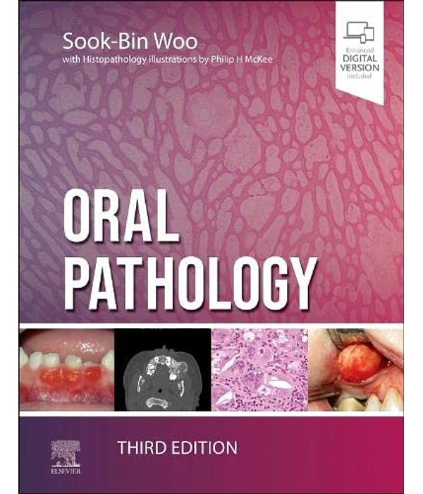 Oral Pathology 3rd Edition, Sook-Bin Woo, B0C1QC3GS3,  032382918X, 0323829201,  9780323829182, 9780323829199, 9780323829205, 978-0323829182, 978-0323829199, 978-0323829205