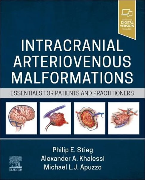 Downlaod Book Intracranial Arteriovenous Malformations: Essentials for Patients and Practitioners, Philip E. Stieg, B0C77D79HK, 0323825303, 032382532X, 9780323825306, 9780323825320, 9780323825313, 978-0323825306, 978-0323825320, 978-0323825313