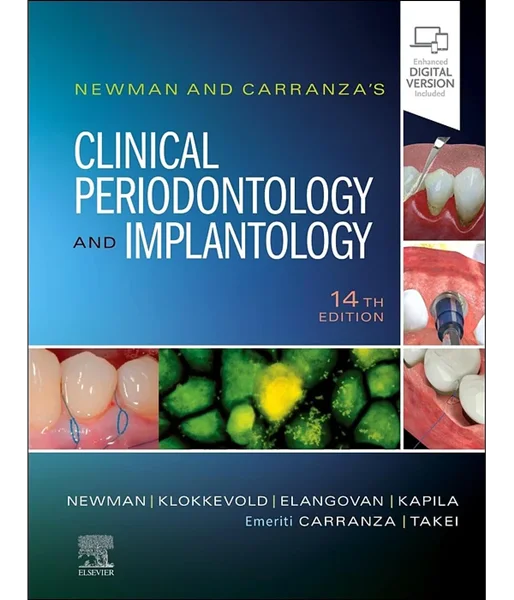 Newman and Carranza's Clinical Periodontology and Implantology 14th Edition, Michael G. Newman, Perry R. Klokkevold, Satheesh, 0323878873, 0323878911, 9780323878913, 9780323878876, 9780323878883, 978-0323878913, 978-0323878876, 978-0323878883, B0C46K1FNL