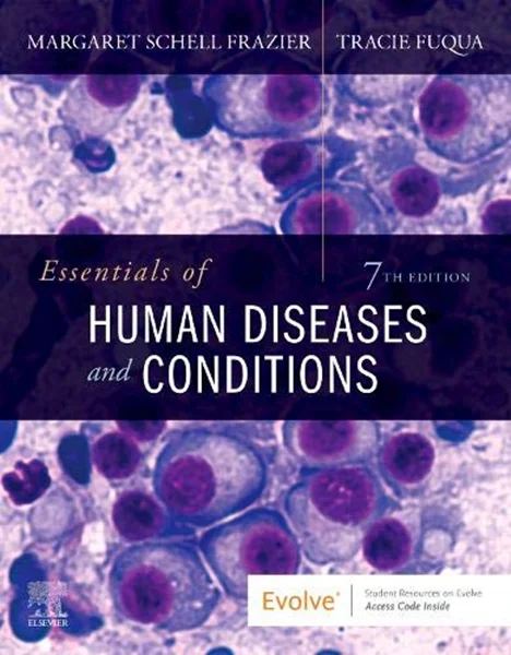 Download Book Essentials of Human Diseases and Conditions, 7th Edition, B08GQ663TR, 0323749690, 9780323712675, 9780323712682, 9780014680351, 9780323749695, 9780323712699, 978-0323712675, 978-0323712682, 978-0014680351, 978-0323749695, 978-0323712699