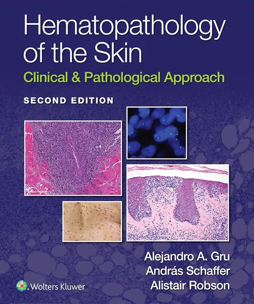 Download Book Hematopathology of the Skin: Clinical & Pathological Approach, 2nd Edition, Alejandro A. Gru; Andras Schaffer; Alistair Robson , B0BVCMVN67, 1975158555, 197515858X, 9781975158552, 9781975158583, 978-1975158552, 978-1975158583