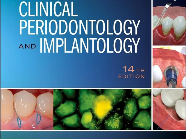Download Book Newman and Carranza's Clinical Periodontology and Implantology, 14th Edition, Michael G. Newman, 0323878873, 0323878911, 9780323878913, 9780323878876, 9780323878883, 978-0323878913, 978-0323878876, 978-0323878883, B0C46K1FNL