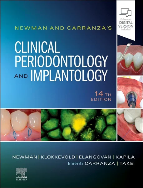 Download Book Newman and Carranza's Clinical Periodontology and Implantology, 14th Edition, Michael G. Newman, 0323878873, 0323878911, 9780323878913, 9780323878876, 9780323878883, 978-0323878913, 978-0323878876, 978-0323878883, B0C46K1FNL