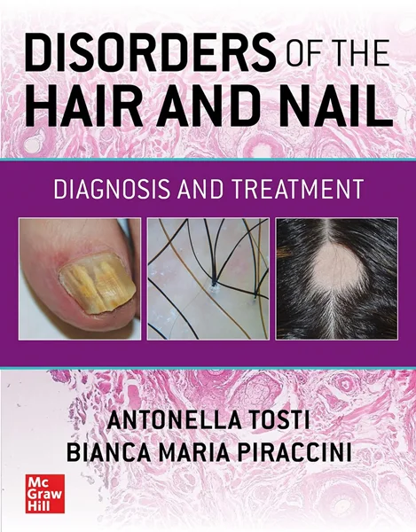 Download Book Disorders of the Hair and Nail: Diagnosis and Treatment, Antonella Tosti; Bianca Maria Piraccini, B0BTDWGXWW, 1260462471, 126046248X, 9781260462470, 9781260462487, 978-1260462470, 978-1260462487