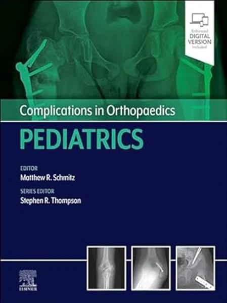 Download Book Complications in Orthopaedics: Pediatrics, Matthew Schmitz, Stephen Thompson, 0323874045, 9780323874038, 9780323873970, 9780323874045, 978-0323874038, 978-0323873970, 978-0323874045