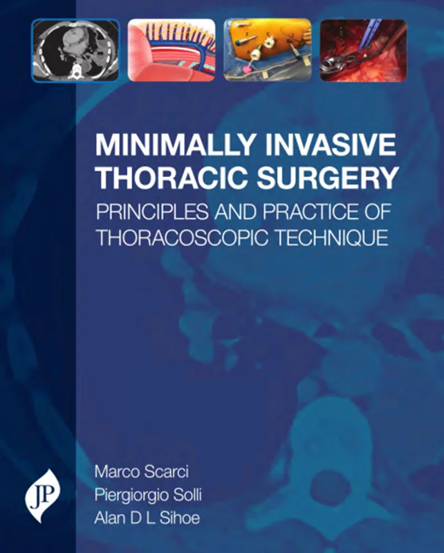 Minimally Invasive Thoracic Surgery: Principles and Practice of Thoracoscopic Technique