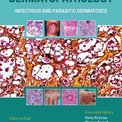 Atlas of Clinical Dermatopathology: Infectious and Parasitic Dermatoses