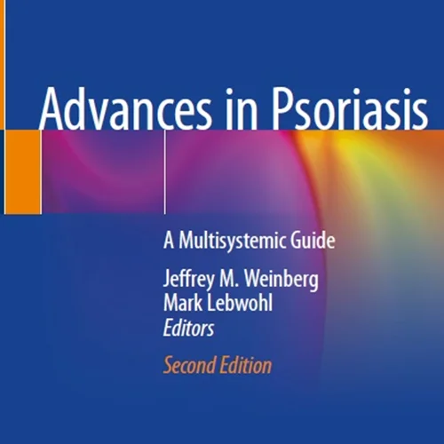 Advances in Psoriasis: A Multisystemic Guide
