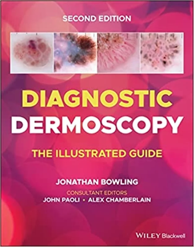 Diagnostic Dermoscopy: The Illustrated Guide, 2nd Edition