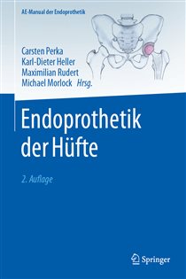 Endoprothetik der Hüfte (2nd ed.)