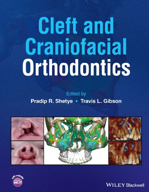 Cleft and Craniofacial Orthodontics