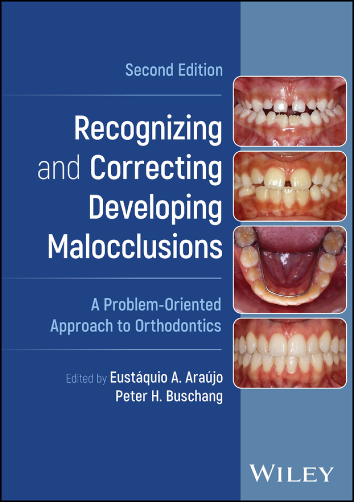 Recognizing and Correcting Developing Malocclusions: A Problem-Oriented Approach to Orthodontics 2nd Edition
