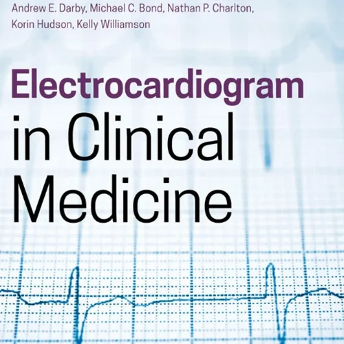 Electrocardiogram in Clinical Medicine