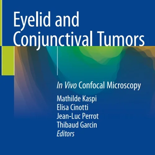 دانلود کتاب تومور های پلک و ملتحمه: بررسی میکروسکوپ کانونی در شرایط درون بدن