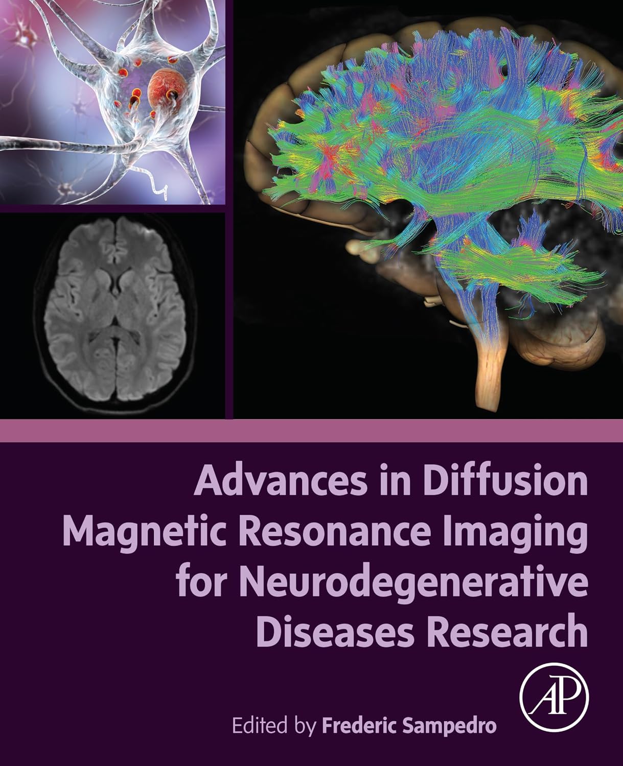 Advances in Diffusion Magnetic Resonance Imaging for Neurodegenerative Diseases Research