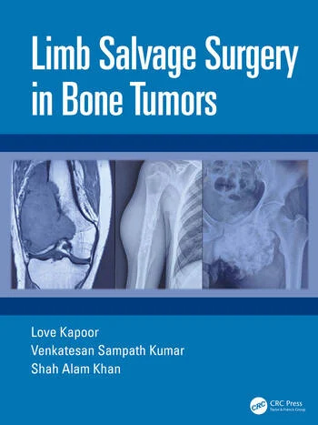Limb Salvage Surgery in Bone Tumors By Love Kapoor, Venkatesan Sampath Kumar, Shah Alam Khan
