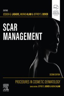 Scar Management - E-BOOK (2nd ed.)