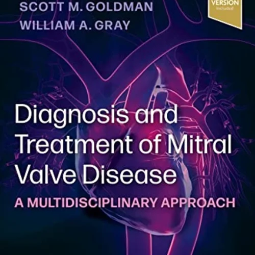 Diagnosis and Treatment of Mitral Valve Disease: A Multidisciplinary Approach