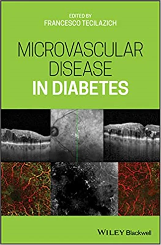 دانلود کتاب بیماری ریز عروقی در دیابت