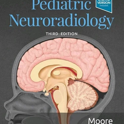 دانلود کتاب تصویربرداری تشخیصی: نورورادیولوژی کودکان