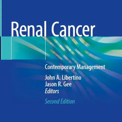 Renal Cancer: Contemporary Management