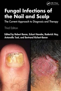 Fungal Infections of the Nail and Scalp (3rd ed.) The Current Approach to Diagnosis and Therapy