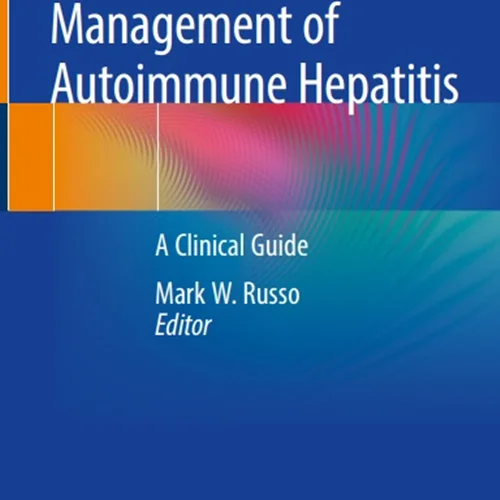 Diagnosis and Management of Autoimmune Hepatitis: A Clinical Guide