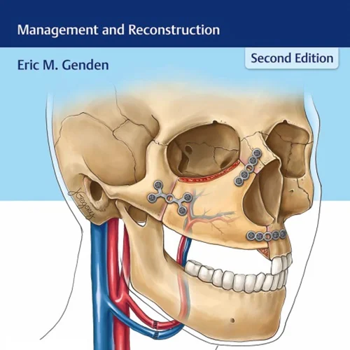 Head and Neck Cancer: Management and Reconstruction, 2nd Edition