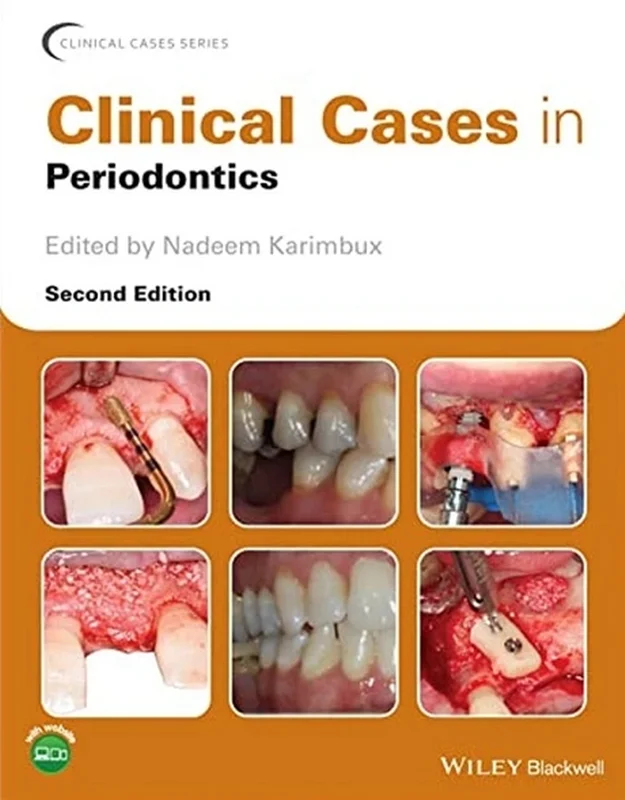 دانلود کتاب موارد بالینی در پریودنتیک، ویرایش دوم (موارد کلینیکی در پریودنتیکس؛ پیرامون دندان)
