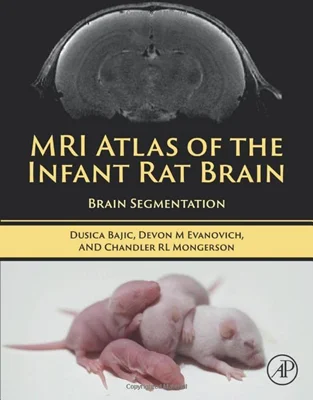 MRI Atlas of the Infant Rat Brain: Brain Segmentation