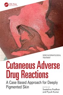 Cutaneous Adverse Drug Reactions A Case Based Approach for Deeply Pigmented Skin