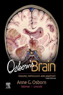 Osborn's Brain E-Book (3rd ed.)