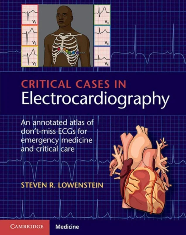 Critical Cases in Electrocardiography: An Annotated Atlas of Don’t-Miss ECGs for Emergency Medicine and Critical Care