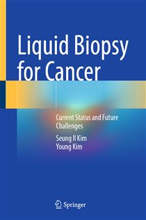 Liquid Biopsy for Cancer Current Status and Future Challenges