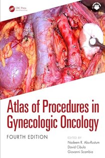 Atlas of Procedures in Gynecologic Oncology (4th ed.)