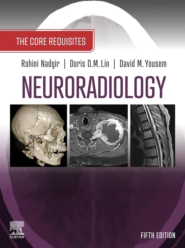 Neuroradiology: The Requisites: The Core Requisites 5th Edition