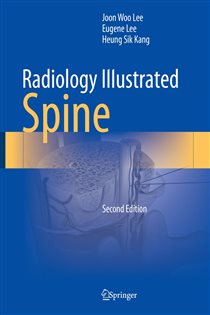 Radiology Illustrated: Spine (2nd ed.)