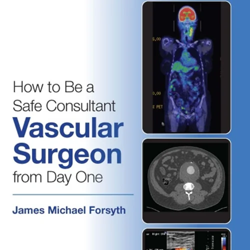 How to be a Safe Consultant Vascular Surgeon from Day One