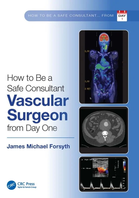 How to be a Safe Consultant Vascular Surgeon from Day One