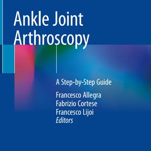 Ankle Joint Arthroscopy: A Step-by-Step Guide