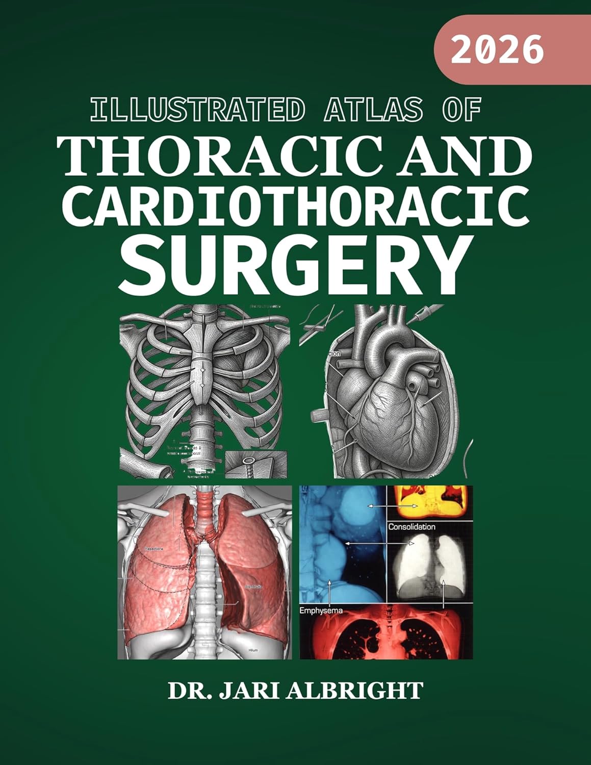 ILLUSTRATED ATLAS OF THORACIC AND CARDIOTHORACIC SURGERY