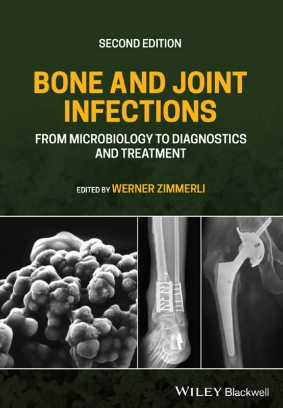 دانلود کتاب عفونت های استخوانی و مفصلی: از میکروبیولوژی تا تشخیص و درمان
