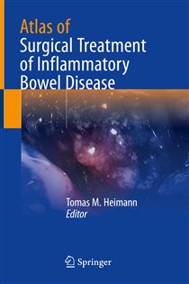 Atlas of Surgical Treatment of Inflammatory Bowel Disease