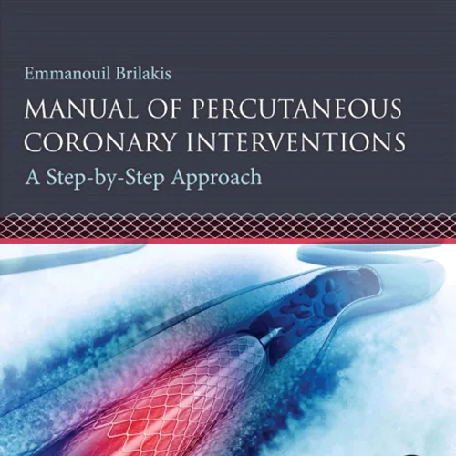 Manual of Percutaneous Coronary Interventions: A Step-by-Step Approach