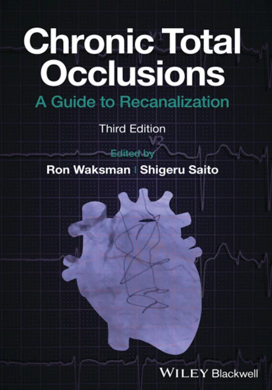 Chronic Total Occlusions: A Guide to Recanalization