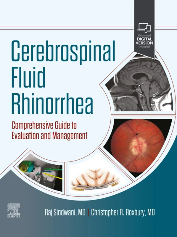 Cerebrospinal Fluid Rhinorrhea: Comprehensive Guide to Evaluation and Management