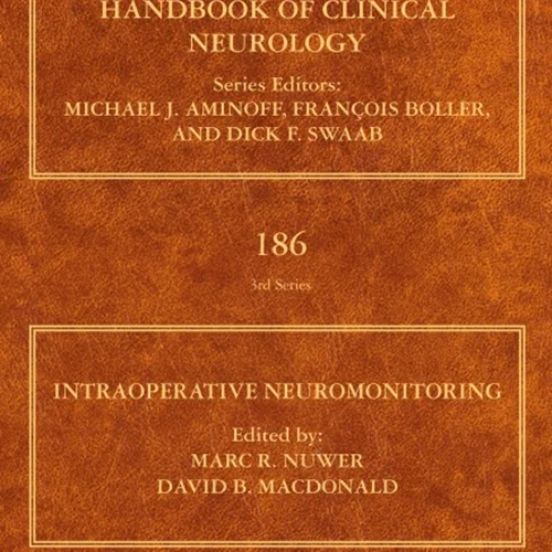 Intraoperative Neuromonitoring (ISSN)