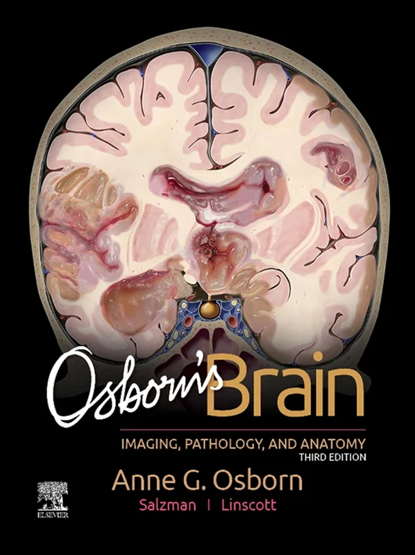 Osborn's Brain: Imaging, Pathology and Anatomy 3rd Edition
